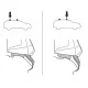 Монтажний комплект Thule 5190 для Honda Civic (mkVIII)(седан) 2005-2012 (TH 145190)